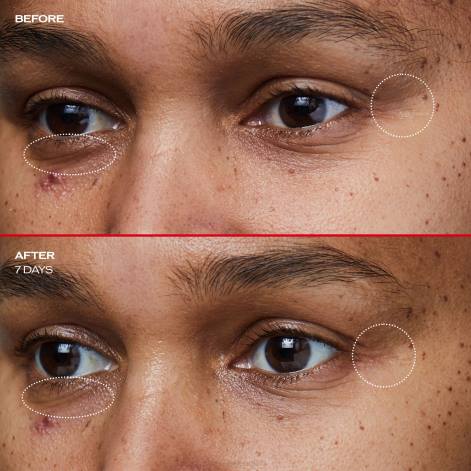 hudpleje Z88246 rynkeudjævnende øjencreme Shiseido