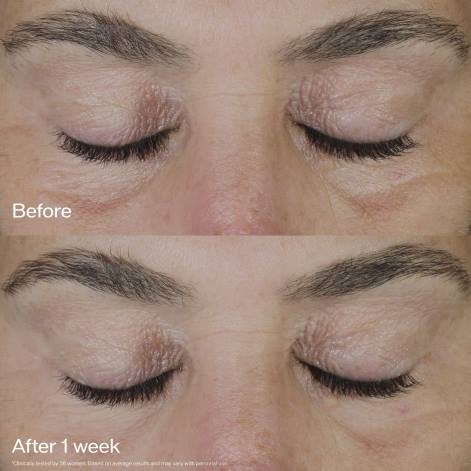 hudpleje Z88248 opløftende og opstrammende øjencreme Shiseido